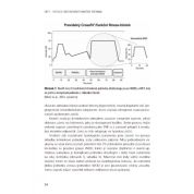 HIFT – Vysoce intenzivní funkční trénink (Petr Schlegel)